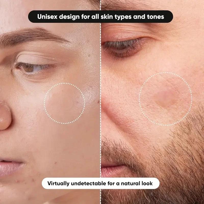 360 pieces/box acne patches -  - Face Oil recension och pris